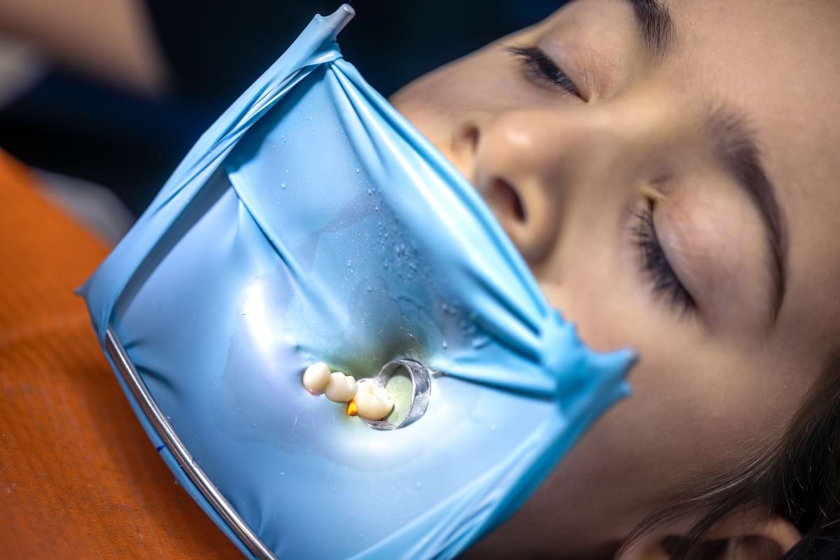 tooth-treatment (1) Пломба на зуб